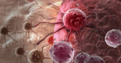 Месяц осведомленности о раке легких: медики напомнили о самом смертоносном виде онкологии