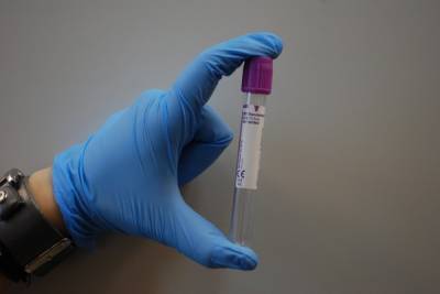 Студенты-медики теперь могут самостоятельно брать тесты на коронавирус