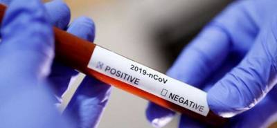 На Днепропетровщине резко выросло количество больных коронавирусом