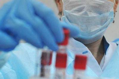 На Кубани коронавирусом заразились 158 человек, в Адыгее - 75