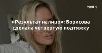 «Результат налицо»: Борисова сделала четвертую подтяжку