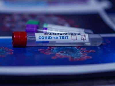 В Молдове зарегистрирован новый коронавирусный антирекорд