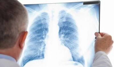 В Украине растет количество больных туберкулезом