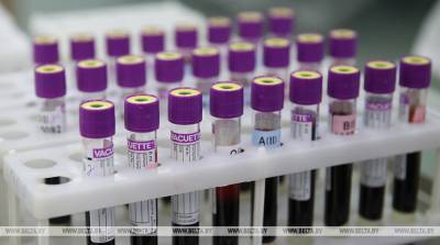В Чехии за сутки выявили в 8 раз меньше зараженных коронавирусом, чем 10 дней назад