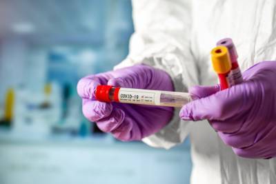 Украинские лаборатории закупают тесты на коронавирус у России