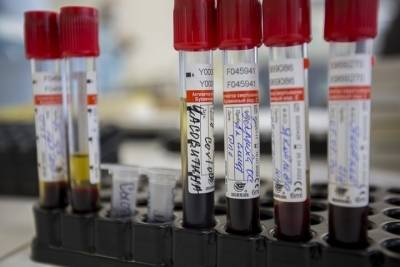 В Роспотребнадзоре сократили срок выполнения теста на коронавирус