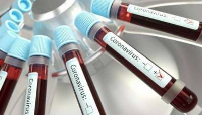 На Луганщине продолжает расти количество инфицированных коронавирусом