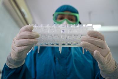 В СКФО выявлено 607 новых случаев коронавируса