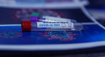 Стало известно, почему не нужен повторный тест на коронавирус