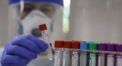 В Крыму выросло количество зараженных коронавирусом