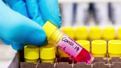 Cокрытие новых случаев коронавируса объяснили в Минздраве
