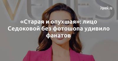 «Старая и опухшая»: лицо Седоковой без фотошопа удивило фанатов