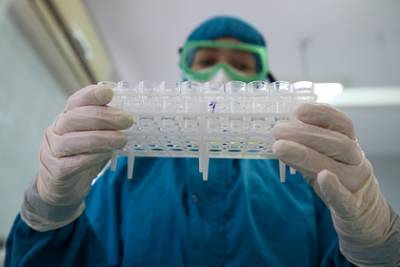 Ученый раскрыл подробности об обнаруженных в России мутациях коронавируса