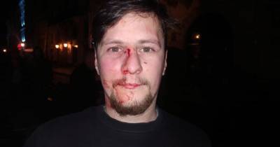 В центре Львова на двух ветеранов АТО напали полицейские и жестоко избили: появилось фото