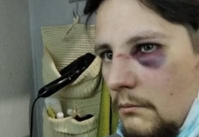 Во Львове на двух ветеранов АТО напали полицейские