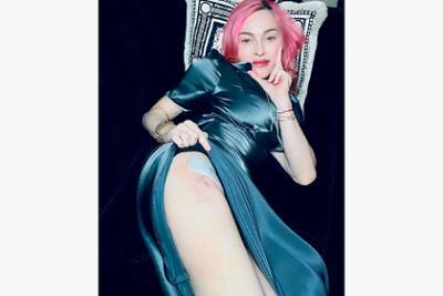 Мадонна показала шрам под платьем после операции