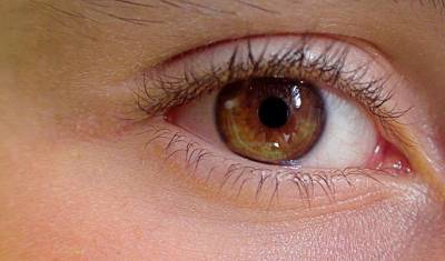 Медики рассказали, о каком заболевании говорит покраснение глаз