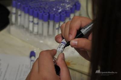 В Липецкой области снизилась заболеваемость ВИЧ-инфекцией на 26,5%