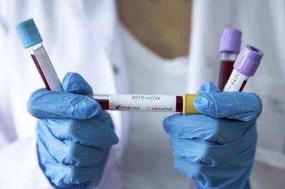 В Украине почти 15 тыс. новых случаев коронавируса за сутки: новый антирекорд