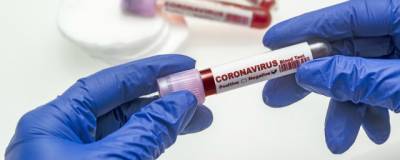 Еще 444 человек в Нижегородской области заразились коронавирусом