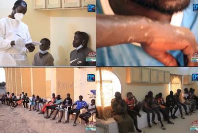 "Заподозрили что-то токсичное": в Сенегале сотни рыбаков покрылись болезненной сыпью