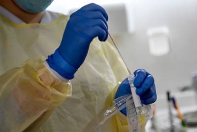 Прирост заражений коронавирусом за октябрь превысил прирост за полгода пандемии