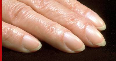 Проблему с пальцами назвали признаком злокачественной опухоли