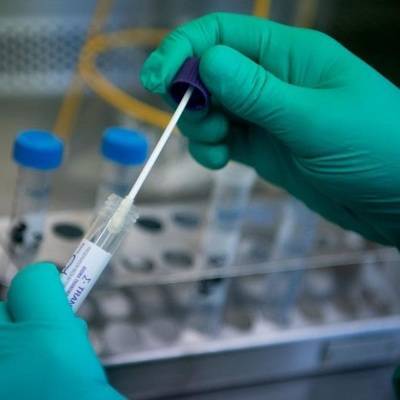 Москвичи будут получать результаты ПЦР-тестов на коронавирус по СМС