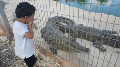 Укус крокодила в Араве: врачи спасли руку мальчику, но он может остаться инвалидом