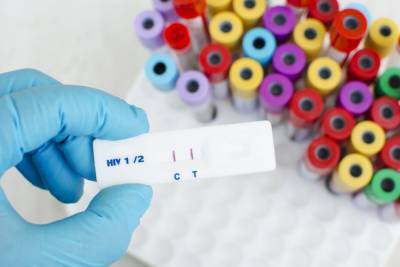Неделя бесплатного тестирования: На Луганщине можно провериться на ВИЧ и вирусный гепатит С​​​​​​​