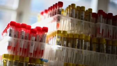 ВОЗ заявила о более 604 тысячах случаев коронавируса в мире за сутки