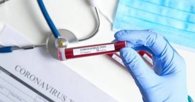 Число заболевших коронавирусом в Украине падает синхронно с сокращением объемов тестирования