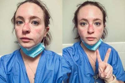 Медсестра из США показала, как изменилась за месяцы работы на передовой борьбы с COVID-19: фото