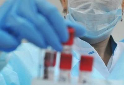 В Украине 12 287 новых случаев коронавируса