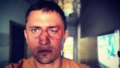 Друг Прилучного рассказал подробности о нападении на актера