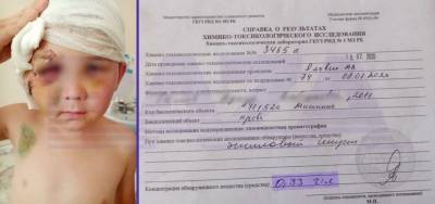 Следком России проконтролирует дело о «пьяном» ребёнке, которого сбила машина