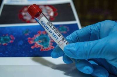 В Черкасской области выросло количество больных коронавирусом
