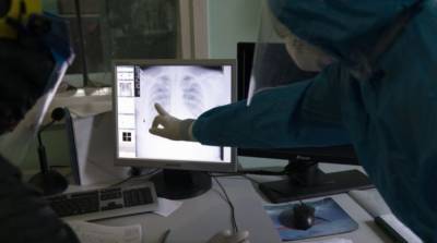 Больным COVID не обязательно делать КТ и рентген – анестезиолог