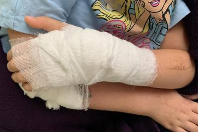 В Калининграде врач прооперировал ребенку здоровую руку