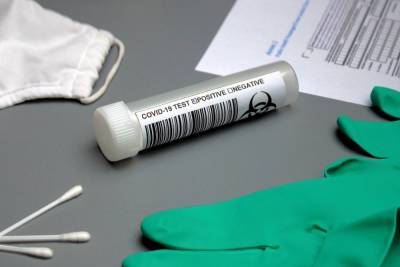 Более 220 тест-систем для выявления коронавируса зарегистрировали в России