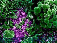Ученые тестируют средство, обещающее покончить с коронавирусом