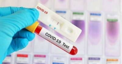 В Черкасской области за сутки выявили более 800 новых случаев COVID-19