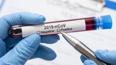 Заболеваемость снова растет: Словакия отложила второе массовое тестирование на COVID-19