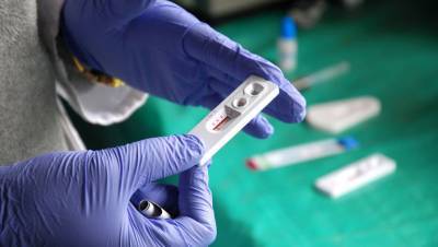 Роспотребнадзор: у людей с ВИЧ возрастет риск заразиться коронавирусом