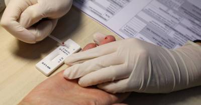 Эксперт: в Латвии продолжает расти число ВИЧ-инфицированных