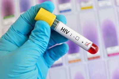 Роспотребнадзор оценил риски заражения ВИЧ-инфицированных COVID-19