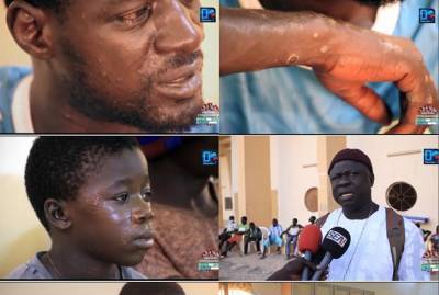 Загадочная болезнь рыбаков в Сенегале таинственно исчезла - kp.ua - Украина - Сенегал - Дакар