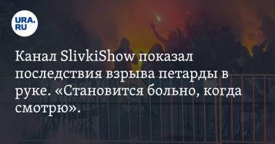 Канал SlivkiShow показал последствия взрыва петарды в руке. «Становится больно, когда смотрю». Видео