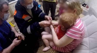Стал синим и опух: в Ярославле спасли двухгодовалого малыша
