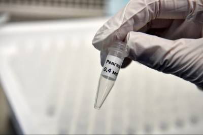 Привлечь к тестированию на коронавирус ветлаборатории и лабораторию МВД планируется в Алтайском крае
